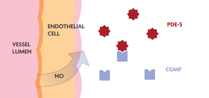 In blood vessels affected by PAH, PDE-5 expression is increased, degrading cGMP and impairing vasodilation.